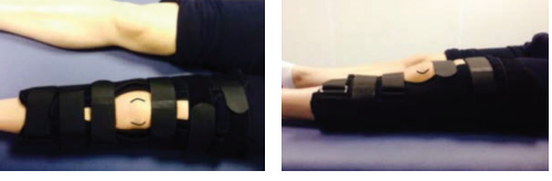 Leg brace