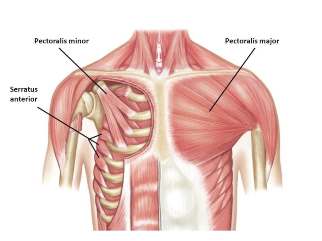 Image showing the position of the pectoralis major and minor before reconstruction.