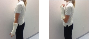 Elbow exercise illustrations