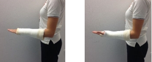 Elbow exercise illustrations 2