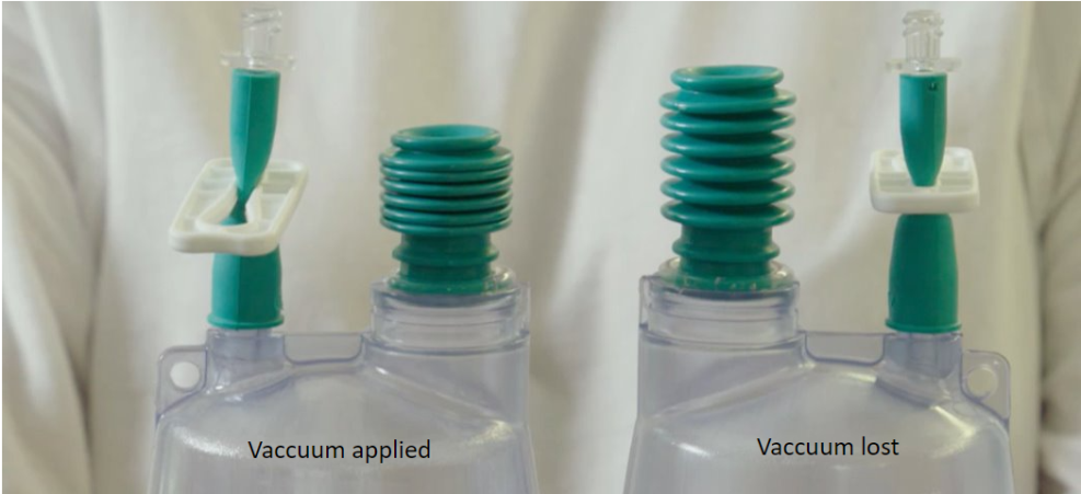 Image of a drain bottle