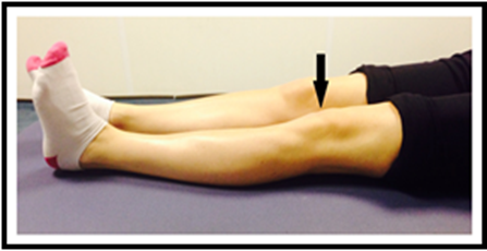 Photo showing patella