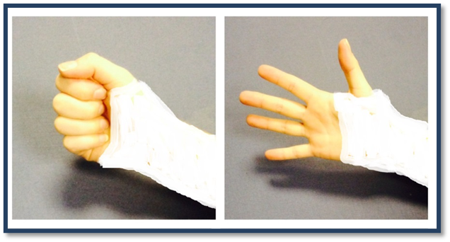 Image showing finger bend and straighten exercise