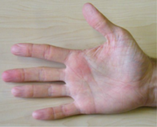 Finger bend exercises. Return to start position