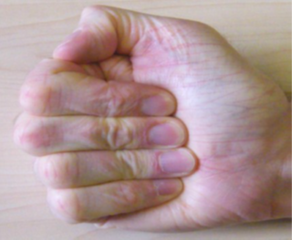 Finger bend exercises. Then bending your fingers, try to touch the base of your hand as shown.