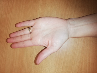 Forearm Rotation, Roll your hands out to bring the palm side facing the ceiling as much as possible. Only go as far as you feel is comfortable.