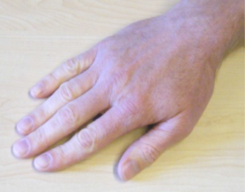 finger walking, Place your hands palm down on a table so they are in line with your forearm.