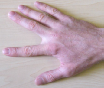 Finger walking, Place it down as close to the thumb as possible.