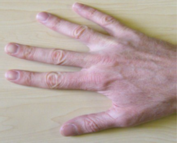 Finger walking, Repeat this process with the other fingers.
 Pick your hands up off the table and return to start position.
