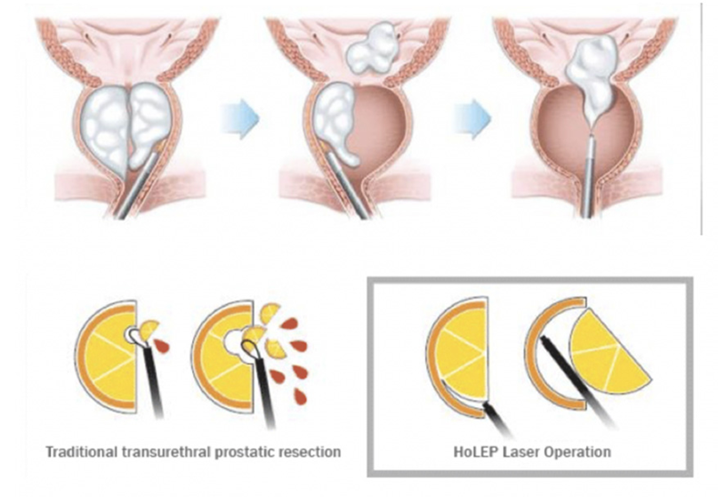 Image showing the prostate