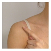 Location of shoulder soft tissue injury
